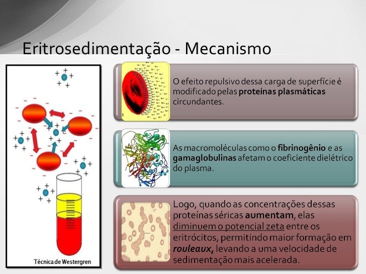 Estudo da velocidade de hemossedimentação (vhs) Estudo da velocidade de hemossedimentação (vhs)