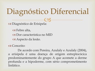  Diagnóstico de Erisipela:
 Febre alta,
 Dor característica no MID
 Aspecto da lesão.
 Conceito:
De acordo com Pereira, Azulaly e Azulaly (2004),
a erisipela é uma doença de origem estreptocócica
predominantemente do grupo A que acomete a derme
profunda e a hipoderme, com sério comprometimento
linfático.
Diagnóstico Diferencial
 