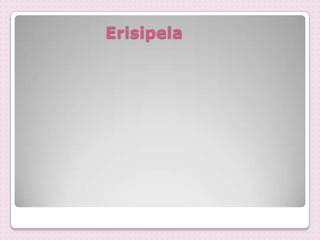 Erisipela
 