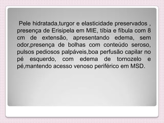 Pele hidratada,turgor e elasticidade preservados ,
presença de Erisipela em MIE, tíbia e fíbula com 8
cm de extensão, apresentando edema, sem
odor,presença de bolhas com conteúdo seroso,
pulsos pediosos palpáveis,boa perfusão capilar no
pé esquerdo, com edema de tornozelo e
pé,mantendo acesso venoso periférico em MSD.
 