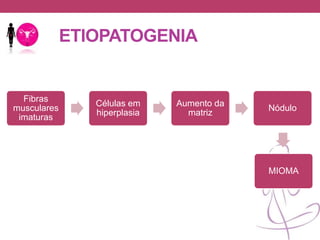 ETIOPATOGENIA
Fibras
musculares
imaturas
Células em
hiperplasia
Aumento da
matriz
Nódulo
MIOMA
 
