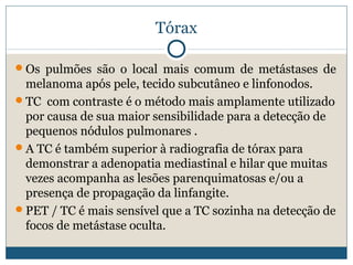 Tórax

Os pulmões são o local mais comum de metástases de
 melanoma após pele, tecido subcutâneo e linfonodos.
TC com contraste é o método mais amplamente utilizado
 por causa de sua maior sensibilidade para a detecção de
 pequenos nódulos pulmonares .
A TC é também superior à radiografia de tórax para
 demonstrar a adenopatia mediastinal e hilar que muitas
 vezes acompanha as lesões parenquimatosas e/ou a
 presença de propagação da linfangite.
PET / TC é mais sensível que a TC sozinha na detecção de
 focos de metástase oculta.
 