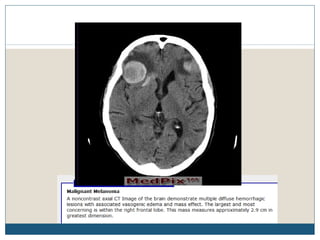 Estudo de casoobs 97 2