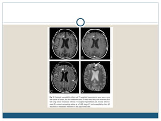 Estudo de casoobs 97 2