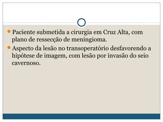 Paciente submetida a cirurgia em Cruz Alta, com
 plano de ressecção de meningioma.
Aspecto da lesão no transoperatório desfavorendo a
 hipótese de imagem, com lesão por invasão do seio
 cavernoso.
 