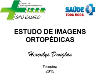 ESTUDO DE IMAGENS
ORTOPÉDICAS
Herculys Douglas
Teresina
2015
 