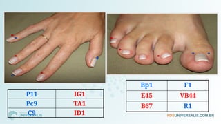 P11 IG1
Pc9 TA1
C9 ID1
Bp1 F1
E45 VB44
B67 R1
 