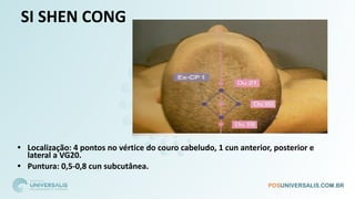 SI SHEN CONG
• Localização: 4 pontos no vértice do couro cabeludo, 1 cun anterior, posterior e
lateral a VG20.
• Puntura: 0,5-0,8 cun subcutânea.
 