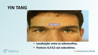 YIN TANG
• Localização: entre as sobrancelhas.
• Puntura: 0,3-0,5 cun subcutânea.
 
