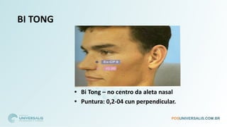 BI TONG
• Bi Tong – no centro da aleta nasal
• Puntura: 0,2-04 cun perpendicular.
 