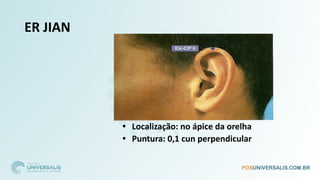ER JIAN
• Localização: no ápice da orelha
• Puntura: 0,1 cun perpendicular
 