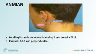 ANMIAN
• Localização: atrás do lóbulo da orelha, 1 cun dorsal a TA17.
• Puntura: 0,5-1 cun perpendicular.
 