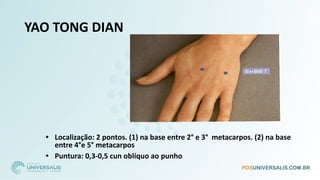 YAO TONG DIAN
• Localização: 2 pontos. (1) na base entre 2° e 3° metacarpos. (2) na base
entre 4°e 5° metacarpos
• Puntura: 0,3-0,5 cun oblíquo ao punho
 