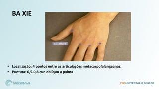 BA XIE
• Localização: 4 pontos entre as articulações metacarpofalangeanas.
• Puntura: 0,5-0,8 cun oblíquo a palma
 