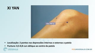 XI YAN
• Localização: 2 pontos nas depressões internas e externas a patela
• Puntura: 0,5-0,8 cun obliqua ao centro da patela
 