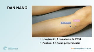 DAN NANG
• Localização: 2 cun abaixo de VB34
• Puntura: 1-1,5 cun perpendicular
 