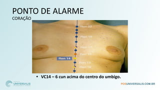 PONTO DE ALARME
CORAÇÃO
• VC14 – 6 cun acima do centro do umbigo.
 