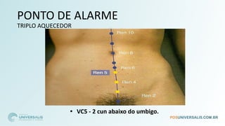 PONTO DE ALARME
TRIPLO AQUECEDOR
• VC5 - 2 cun abaixo do umbigo.
 