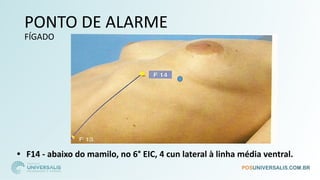 PONTO DE ALARME
FÍGADO
• F14 - abaixo do mamilo, no 6° EIC, 4 cun lateral à linha média ventral.
 