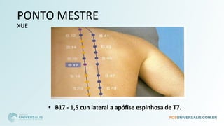 PONTO MESTRE
XUE
• B17 - 1,5 cun lateral a apófise espinhosa de T7.
 