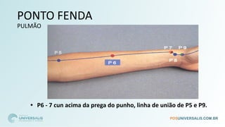 PONTO FENDA
PULMÃO
• P6 - 7 cun acima da prega do punho, linha de união de P5 e P9.
 