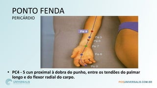 PONTO FENDA
PERICÁRDIO
• PC4 - 5 cun proximal à dobra do punho, entre os tendões do palmar
longo e do flexor radial do carpo.
 