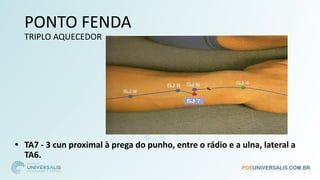 PONTO FENDA
TRIPLO AQUECEDOR
• TA7 - 3 cun proximal à prega do punho, entre o rádio e a ulna, lateral a
TA6.
 