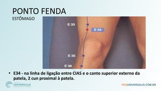 PONTO FENDA
ESTÔMAGO
• E34 - na linha de ligação entre CIAS e o canto superior externo da
patela, 2 cun proximal à patela.
 