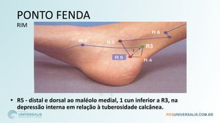 PONTO FENDA
RIM
• R5 - distal e dorsal ao maléolo medial, 1 cun inferior a R3, na
depressão interna em relação à tuberosidade calcânea.
R3
 
