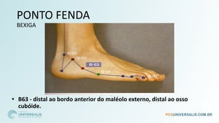 PONTO FENDA
BEXIGA
• B63 - distal ao bordo anterior do maléolo externo, distal ao osso
cubóide.
 