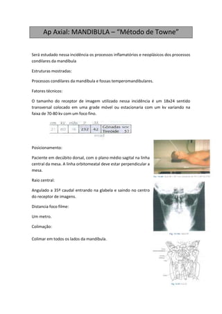 Ap Axial: MANDIBULA – “Método de Towne”

Será estudado nessa incidência os processos inflamatórios e neoplásicos dos processos
condilares da mandíbula

Estruturas mostradas:

Processos condilares da mandíbula e fossas temperomandibulares.

Fatores técnicos:

O tamanho do receptor de imagem utilizado nessa incidência é um 18x24 sentido
transversal colocado em uma grade móvel ou estacionaria com um kv variando na
faixa de 70-80 kv com um foco fino.




Posicionamento:

Paciente em decúbito dorsal, com o plano médio sagital na linha
central da mesa. A linha orbitomeatal deve estar perpendicular a
mesa.

Raio central:

Angulado a 35º caudal entrando na glabela e saindo no centro
do receptor de imagens.

Distancia foco filme:

Um metro.

Colimação:

Colimar em todos os lados da mandíbula.
 