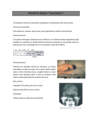FRONTO-NASO-“CALDWELL”

É estudado as fraturas e processos neoplásicos e inflamatórios dos ossos faciais.

Estruturas mostradas:

Orla orbitraria, maxilas, septo nasal, ossos zigomáticos, espinha nasal anterior;

Fatores técnicos:

O receptor deimagem utilizado nessa incidência é um 18x24 sentido longitudinal pode
também ser utilizado um 24x30 sentido transversal colocado em uma grade móvel ou
estacionaria com a utilização de um kv variando na faixa de 70-80 kv;




Posicionamento:

Paciente em decúbito ventral ou ortostasa, os bracos
estendidos ao lado do corpo com o plano médio sagital
sobre a linha central da mesa, a região frontal e o nariz
devem estar apoiados sobre a mesa ou estativa, linha
orbito meatal perpendicular ao plano da mesa.

Raio central:

Angulado 15ºcaudal, para sair no nasio

Distancia foco filme é de um metro

Colimação:

Colimar todos os lados dos ossos faciais.
 