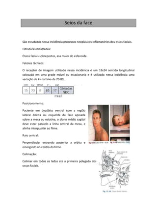 Seios da face


São estudados nessa incidência processos neoplásicos inflamatórios dos ossos faciais.

Estruturas mostradas:

Ossos faciais sobrepostos, asa maior do esfenoide.

Fatores técnicos:

O receptor de imagem utilizado nessa incidência é um 18x24 sentido longitudinal
colocado em uma grade móvel ou estacionaria e é utilizado nessa incidência uma
variação de kv na faixa de 70-80;




Posicionamento:

Paciente em decúbito ventral com a região
lateral direita ou esquerda da face apoiada
sobre a mesa ou estativa, o plano médio sagital
deve estar paralelo a linha central da mesa, e
alinha interpupilar ao filme.

Raio central:

Perpendicular entrando posterior a orbita e
emergindo no centro do filme.

Colimação:

Colimar em todos os lados ate a primeira polegada dos
ossos faciais.
 