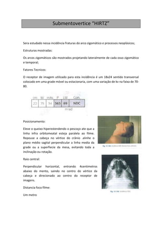 Submentovertice “HIRTZ”


Sera estudado nessa incidência fraturas do arco zigomático e processos neoplásicos;

Estruturas mostradas:

Os arcos zigomáticos são mostrados projetando lateralmente de cada osso zigomático
e temporal;

Fatores Tecnicos:

O receptor de imagem utilizado para esta incidência é um 18x24 sentido transversal
colocado em uma grade móvel ou estacionaria, com uma variação de kv na faixa de 70-
80.




Posicionamento:

Eleve o queixo hiperestendendo o pescoço ate que a
linha infra orbitomeatal esteja paralela ao filme.
Repouse a cabeça no vértice do crânio .alinhe o
plano médio sagital perpendicular a linha media da
grade ou a superfiecie da mesa, evitando toda a
inclinação ou rotação.

Raio central:

Perpendicular horizontal, entrando 4centimetros
abaixo do mento, saindo no centro do vértice da
cabeça e direcionado ao centro do receptor de
imagens.

Distancia foco filme:

Um metro
 