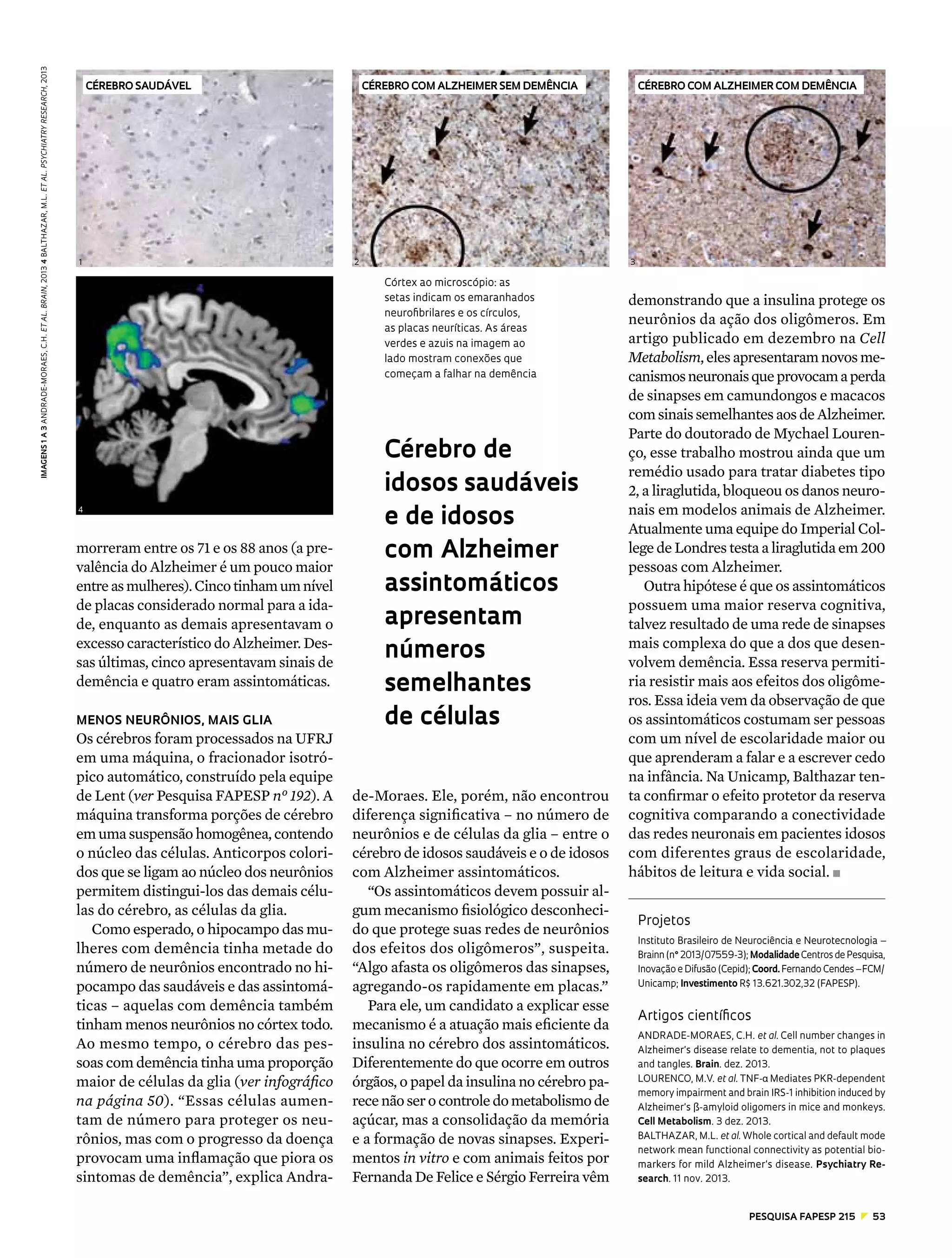 imagens 1 a 3 ANDRADE-MORAES, C.H. et al. Brain, 2013 4 balthazar, m.l. et al. Psychiatry research, 2013

Cérebro saudável

1

Cérebro com alzheimer sem demência

2

3

Córtex ao microscópio: as
setas indicam os emaranhados
neurofibrilares e os círculos,
as placas neuríticas. As áreas
verdes e azuis na imagem ao
lado mostram conexões que
começam a falhar na demência

4

morreram entre os 71 e os 88 anos (a prevalência do Alzheimer é um pouco maior
entre as mulheres). Cinco tinham um nível
de placas considerado normal para a idade, enquanto as demais apresentavam o
excesso característico do Alzheimer. Dessas últimas, cinco apresentavam sinais de
demência e quatro eram assintomáticas.
menos neurônios, mais glia

Os cérebros foram processados na UFRJ
em uma máquina, o fracionador isotrópico automático, construído pela equipe
de Lent (ver Pesquisa FAPESP nº 192). A
máquina transforma porções de cérebro
em uma suspensão homogênea, contendo
o núcleo das células. Anticorpos coloridos que se ligam ao núcleo dos neurônios
permitem distingui-los das demais células do cérebro, as células da glia.
Como esperado, o hipocampo das mulheres com demência tinha metade do
número de neurônios encontrado no hipocampo das saudáveis e das assintomáticas – aquelas com demência também
tinham menos neurônios no córtex todo.
Ao mesmo tempo, o cérebro das pessoas com demência tinha uma proporção
maior de células da glia (ver infográfico
na página 50). “Essas células aumentam de número para proteger os neurônios, mas com o progresso da doença
provocam uma inflamação que piora os
sintomas de demência”, explica Andra-

Cérebro com alzheimer com demência

Cérebro de
idosos saudáveis
e de idosos
com Alzheimer
assintomáticos
apresentam
números
semelhantes
de células
de-Moraes. Ele, porém, não encontrou
diferença significativa ­ no número de
–
neurônios e de células da glia – entre o
cérebro de idosos saudáveis e o de idosos
com Alzheimer assintomáticos.
“Os assintomáticos devem possuir algum mecanismo fisiológico desconhecido que protege suas redes de neurônios
dos efeitos dos oligômeros”, suspeita.
“Algo afasta os oligômeros das sinapses,
agregando-os rapidamente em placas.”
Para ele, um candidato a explicar esse
mecanismo é a atuação mais eficiente da
insulina no cérebro dos assintomáticos.
Diferentemente do que ocorre em outros
órgãos, o papel da insulina no cérebro parece não ser o controle do metabolismo de
açúcar, mas a consolidação da memória
e a formação de novas sinapses. Experimentos in vitro e com animais feitos por
Fernanda De Felice e Sérgio Ferreira vêm

demonstrando que a insulina protege os
neurônios da ação dos oligômeros. Em
artigo publicado em dezembro na Cell
Metabolism, eles apresentaram novos mecanismos neuronais que provocam a perda
de sinapses em camundongos e macacos
com sinais semelhantes aos de Alzheimer.
Parte do doutorado de Mychael Lourenço, esse trabalho mostrou ainda que um
remédio usado para tratar diabetes tipo
2, a liraglutida, bloqueou os danos neuronais em modelos animais de Alzheimer.
Atualmente uma equipe do Imperial College de Londres testa a liraglutida em 200
pessoas com Alzheimer.
Outra hipótese é que os assintomáticos
possuem uma maior reserva cognitiva,
talvez resultado de uma rede de sinapses
mais complexa do que a dos que desenvolvem demência. Essa reserva permitiria resistir mais aos efeitos dos oligômeros. Essa ideia vem da observação de que
os assintomáticos costumam ser pessoas
com um nível de escolaridade maior ou
que aprenderam a falar e a escrever cedo
na infância. Na Unicamp, Balthazar tenta confirmar o efeito protetor da reserva
cognitiva comparando a conectividade
das redes neuronais em pacientes idosos
com diferentes graus de escolaridade,
hábitos de leitura e vida social. n
Projetos
Instituto Brasileiro de Neurociência e Neurotecnologia –
Brainn (n° 2013/07559-3); Modalidade Centros de Pesquisa,
Inovação e Difusão (Cepid); Coord. Fernando Cendes – FCM/
Unicamp; Investimento R$ 13.621.302,32 (FAPESP).

Artigos científicos
ANDRADE-MORAES, C.H. et al. Cell number changes in
Alzheimer’s disease relate to dementia, not to plaques
and tangles. Brain. dez. 2013.
LOURENCO, M.V. et al. TNF- Mediates PKR-dependent
memory impairment and brain IRS-1 inhibition induced by
Alzheimer’s ß-amyloid oligomers in mice and monkeys.
Cell Metabolism. 3 dez. 2013.
BALTHAZAR, M.L. et al. Whole cortical and default mode
network mean functional connectivity as potential biomarkers for mild Alzheimer’s disease. Psychiatry Research. 11 nov. 2013.

pESQUISA FAPESP 215  z  53

 