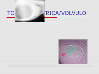 TORÇÃO GÁSTRICA/VOLVULO
 