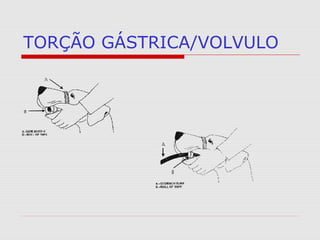 TORÇÃO GÁSTRICA/VOLVULO
 