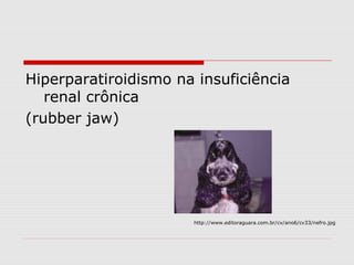 Hiperparatiroidismo na insuficiência
renal crônica
(rubber jaw)
http://www.editoraguara.com.br/cv/ano6/cv33/nefro.jpg
 