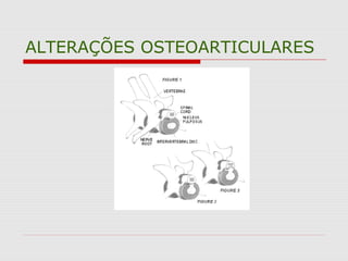 ALTERAÇÕES OSTEOARTICULARES
 