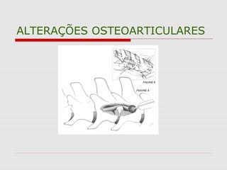 ALTERAÇÕES OSTEOARTICULARES
 