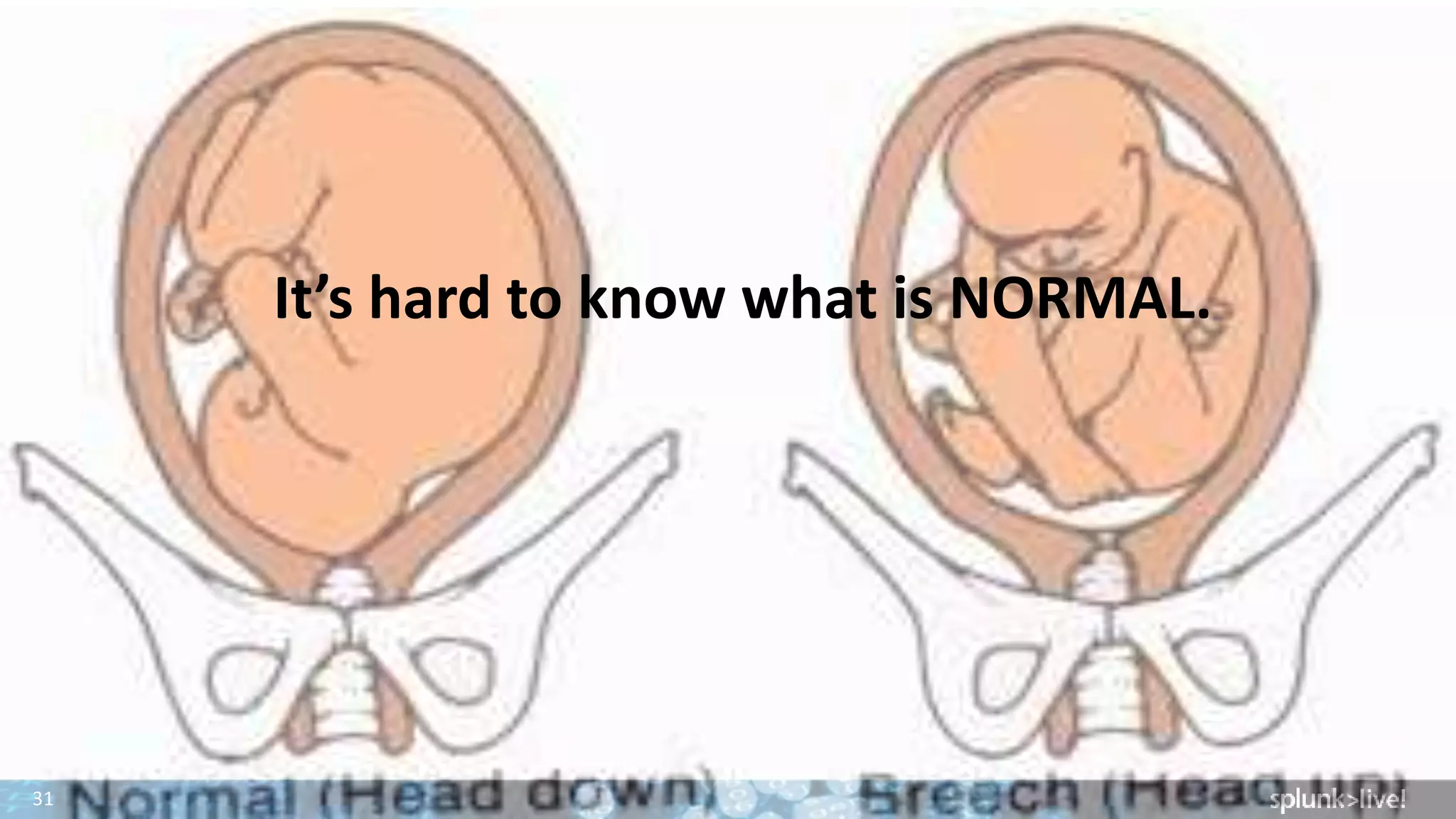 31
It’s hard to know what is NORMAL.
 