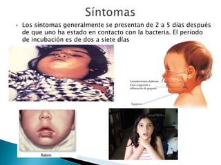    Los síntomas generalmente se presentan de 2 a 5 días después
    de que uno ha estado en contacto con la bacteria. El periodo
    de incubación es de dos a siete días.
 
