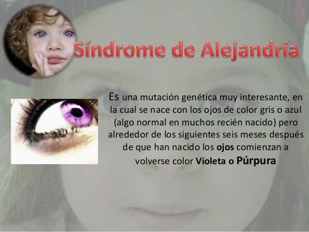 sindrome de alejandria