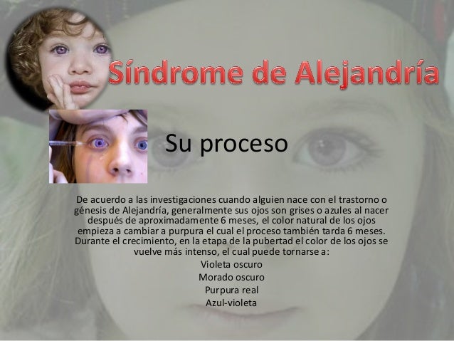 Que Es El Sindrome De Alejandria