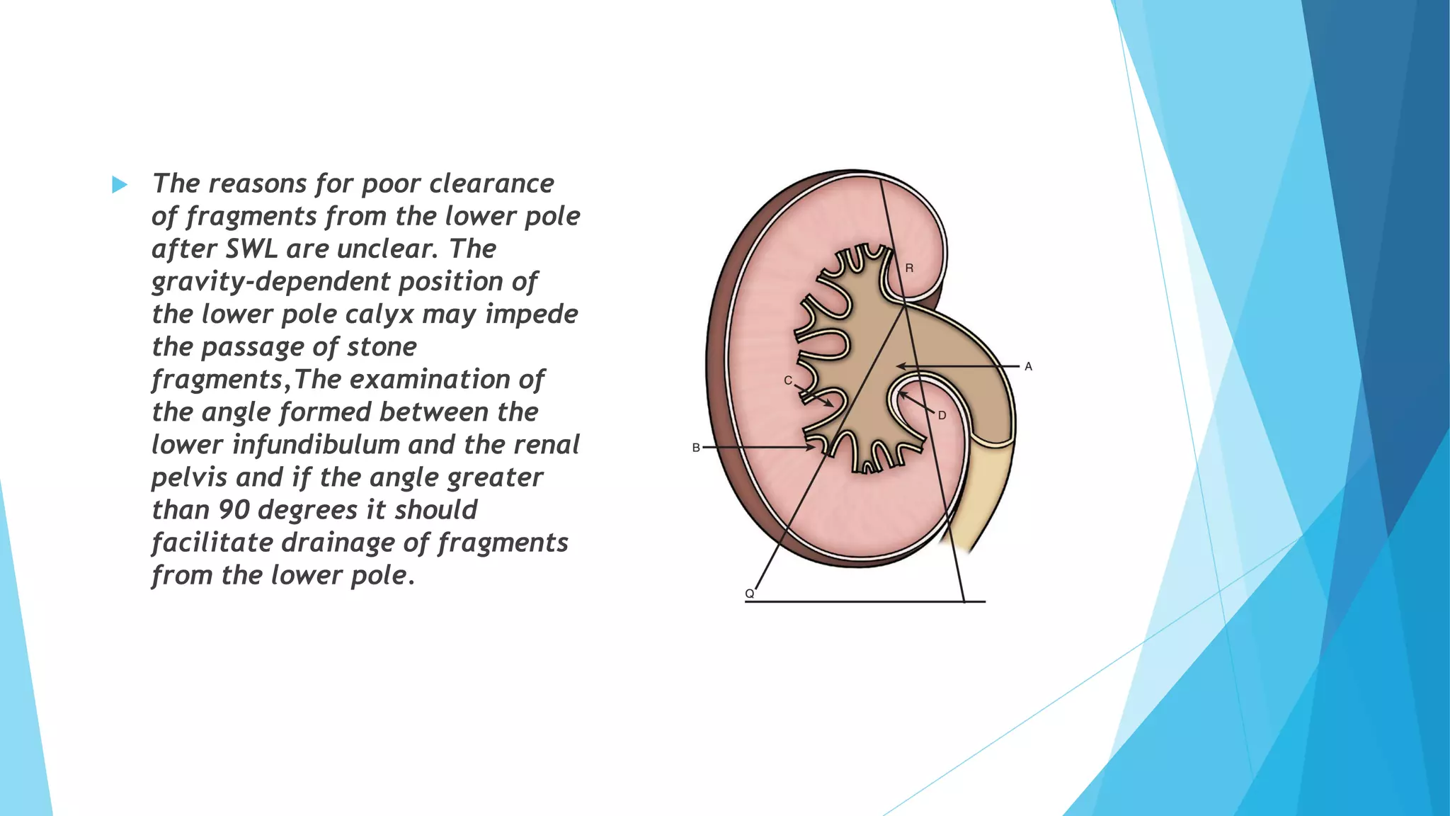  The reasons for poor clearance
of fragments from the lower pole
after SWL are unclear. The
gravity-dependent position of
the lower pole calyx may impede
the passage of stone
fragments,The examination of
the angle formed between the
lower infundibulum and the renal
pelvis and if the angle greater
than 90 degrees it should
facilitate drainage of fragments
from the lower pole.
 