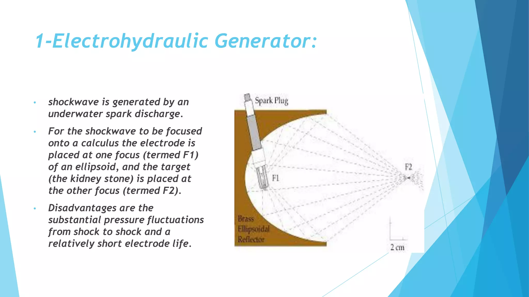 1-Electrohydraulic Generator:
• shockwave is generated by an
underwater spark discharge.
• For the shockwave to be focused
onto a calculus the electrode is
placed at one focus (termed F1)
of an ellipsoid, and the target
(the kidney stone) is placed at
the other focus (termed F2).
• Disadvantages are the
substantial pressure fluctuations
from shock to shock and a
relatively short electrode life.
 