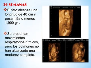30 SEMANAS

El feto alcanza una
longitud de 40 cm y
pesa más o menos
1,900 gr .

Se presentan
movimientos
respiratorios rítmicos,
pero los pulmones no
han alcanzado una
madurez completa.

 