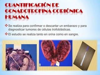 CUANTIFICACIÓN DE
GONADOTROFINA CORIÓNICA
HUMANA
 Se realiza para confirmar o descartar un embarazo y para
diagnosticar tumores de células trofoblásticas.

 El estudio se realiza tanto en orina como en sangre.

 