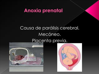 Hemorragia prenatalSe puede presentar por:Placenta previa.