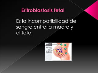 RubeolaEritroblastosis fetalEs la incompatibilidad de sangre entre la madre y el feto.
